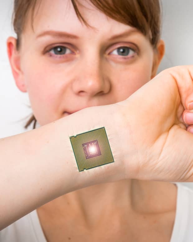 Bionic microchip implant on woman’s arm